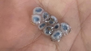 Kadirli'de Nazar Boncuğu Şeklinde Yağan Dolu Şaşkınlık Yarattı